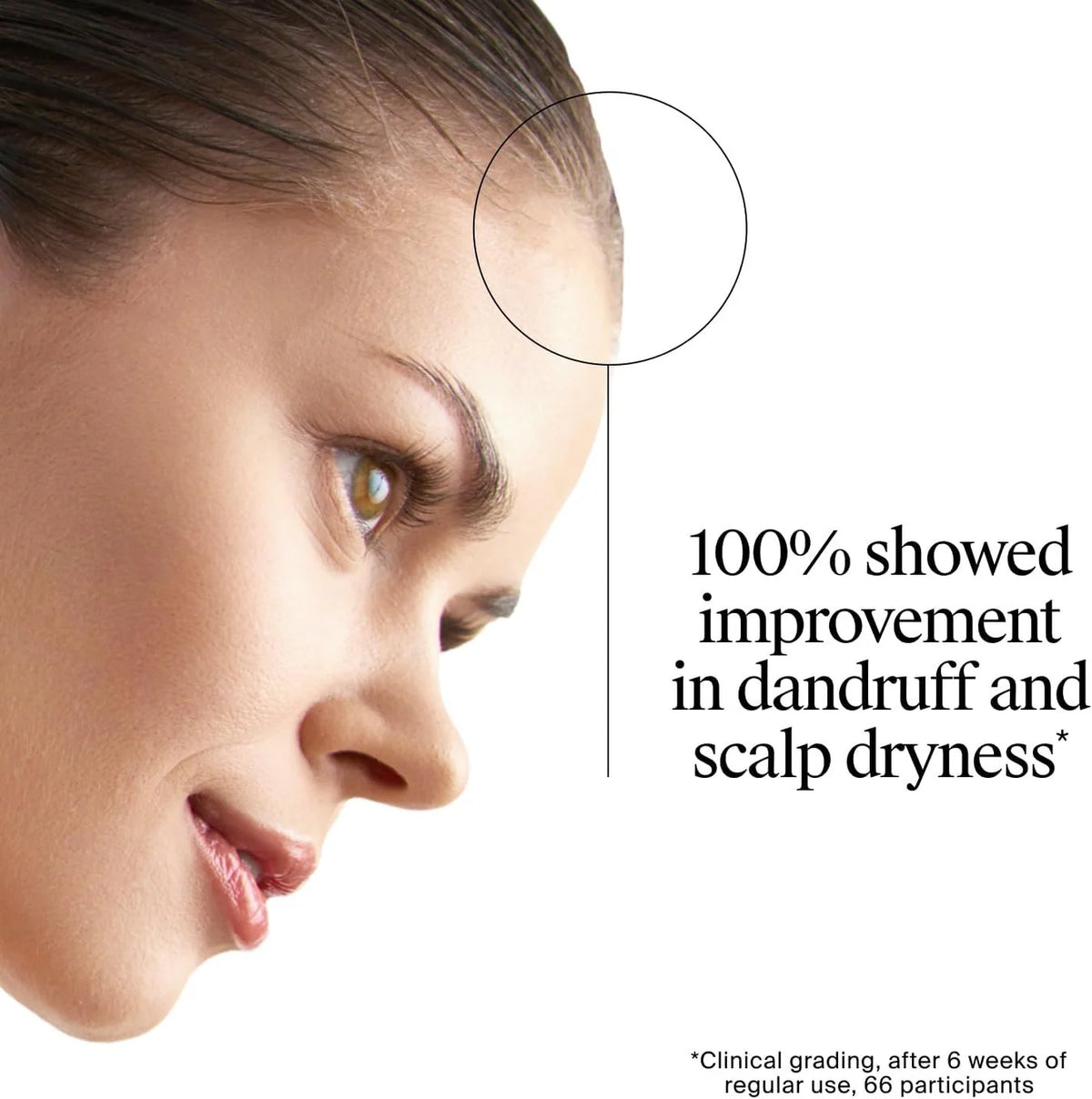 Neutrogena T/Gel Anti-Dandruff Scalp Relief Shampoo - 250ml
