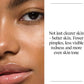 Neutrogena Oil Free Acne Wash For Acne Prone Skin - 269ml